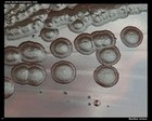 Bacillus cereus